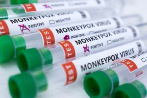 FS still free of monkeypox virus incidents