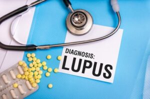 Lupus not a condition that is spread