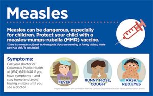 Vaccination against measles rolled out in FS