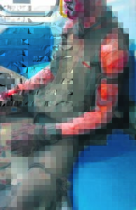 Skin severely branded