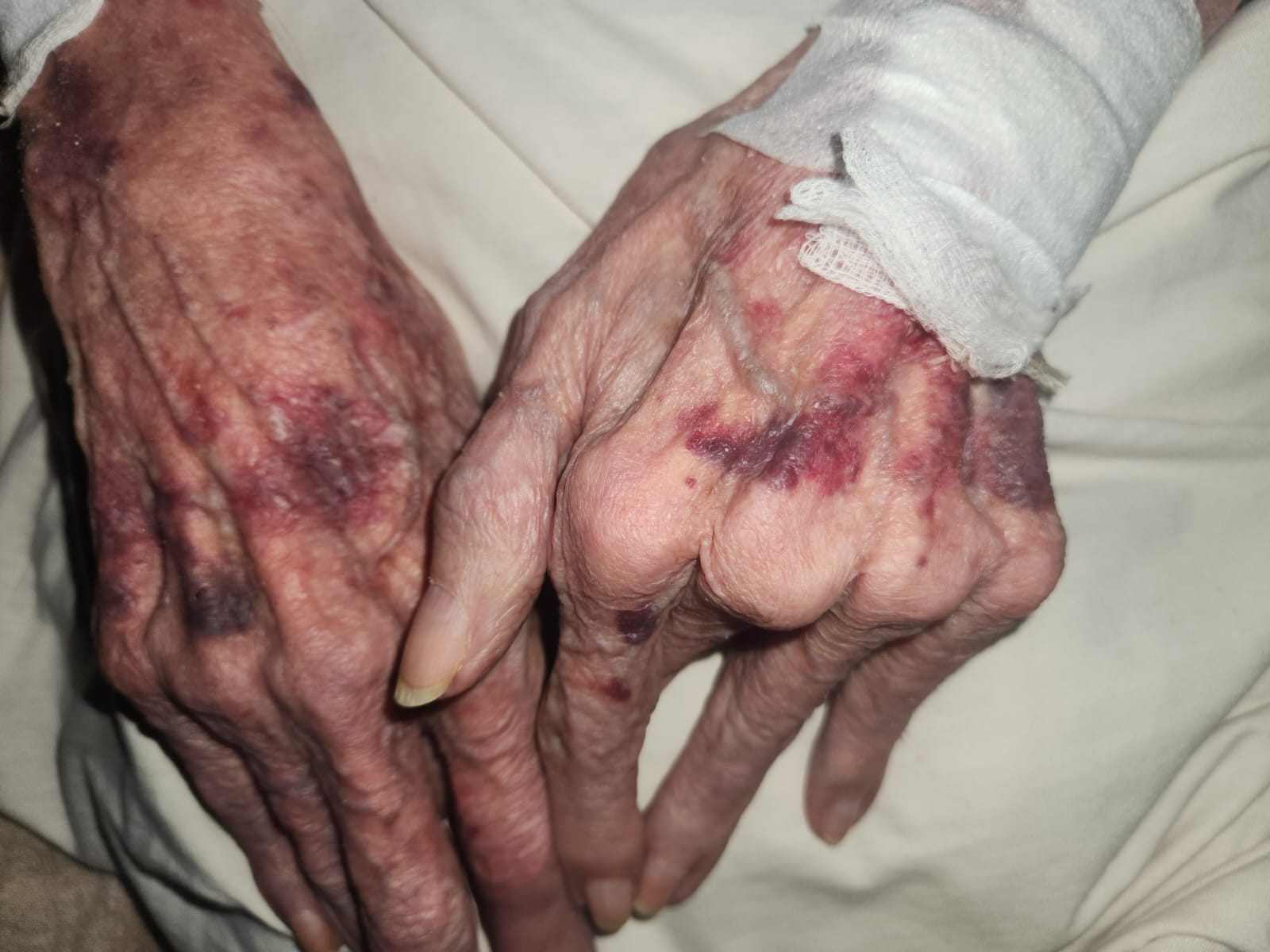 Will the six accused in the assault of a frail elderly woman get bail on Friday?