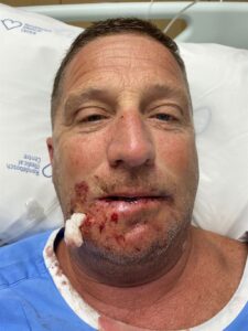 US tourist shot and injured in Nyanga, Cape Town