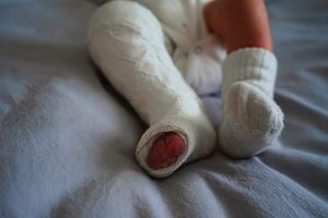 STEPS unlocks opportunities for thousands of kids with clubfoot