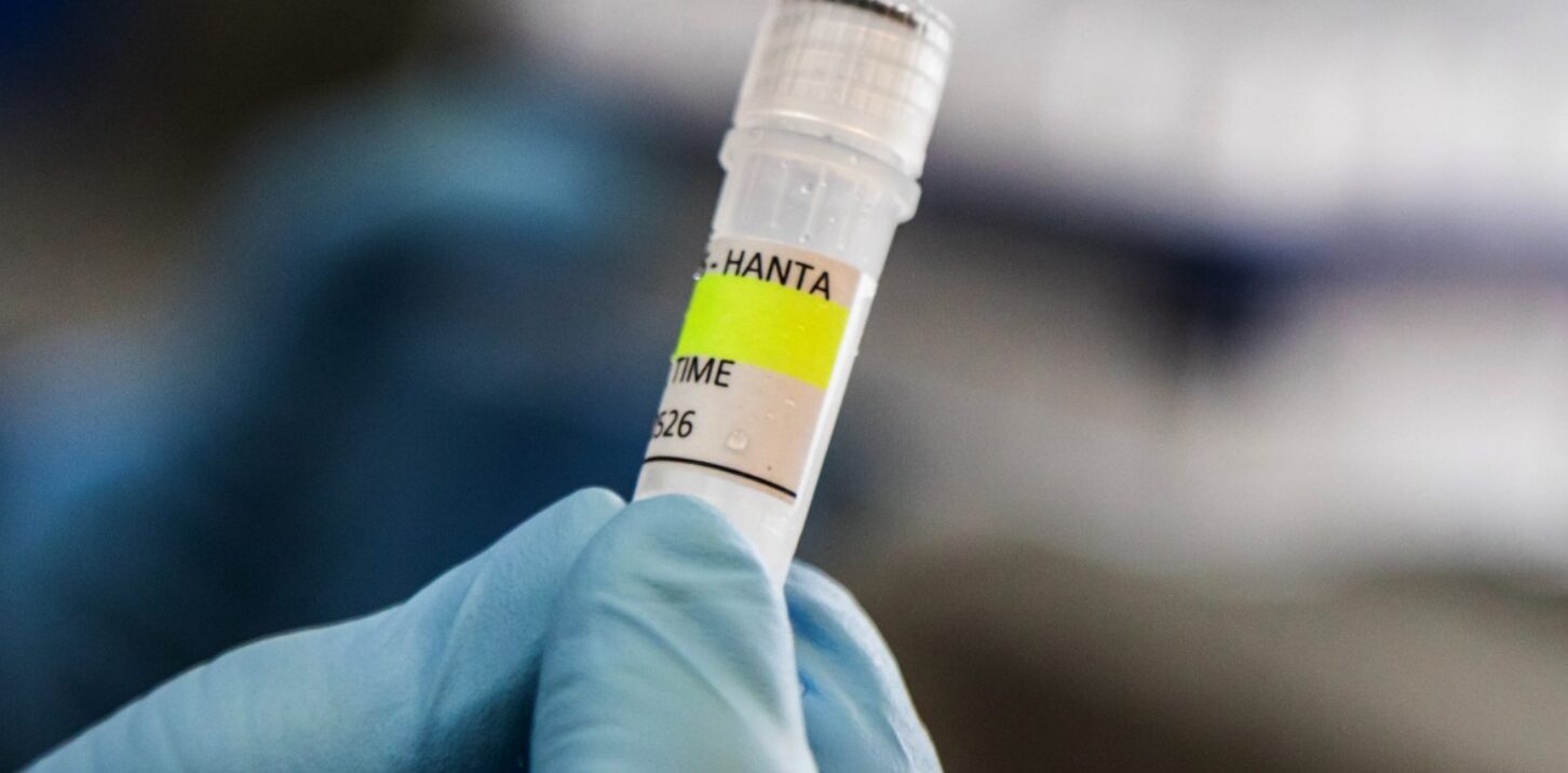 Só lyk die wedloop om vir hantavirus op ’n passasierskip te toets
