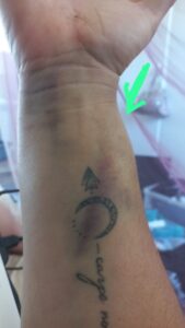 Mediclinic Vergelegen accused of misdiagnosis