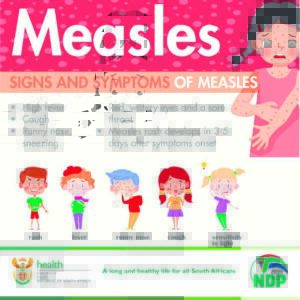 Inoculate your child against Cape Metro’s measles outbreak