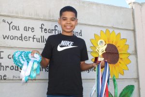 Steps to success: Malakai Leibrandt’s triumph over clubfoot