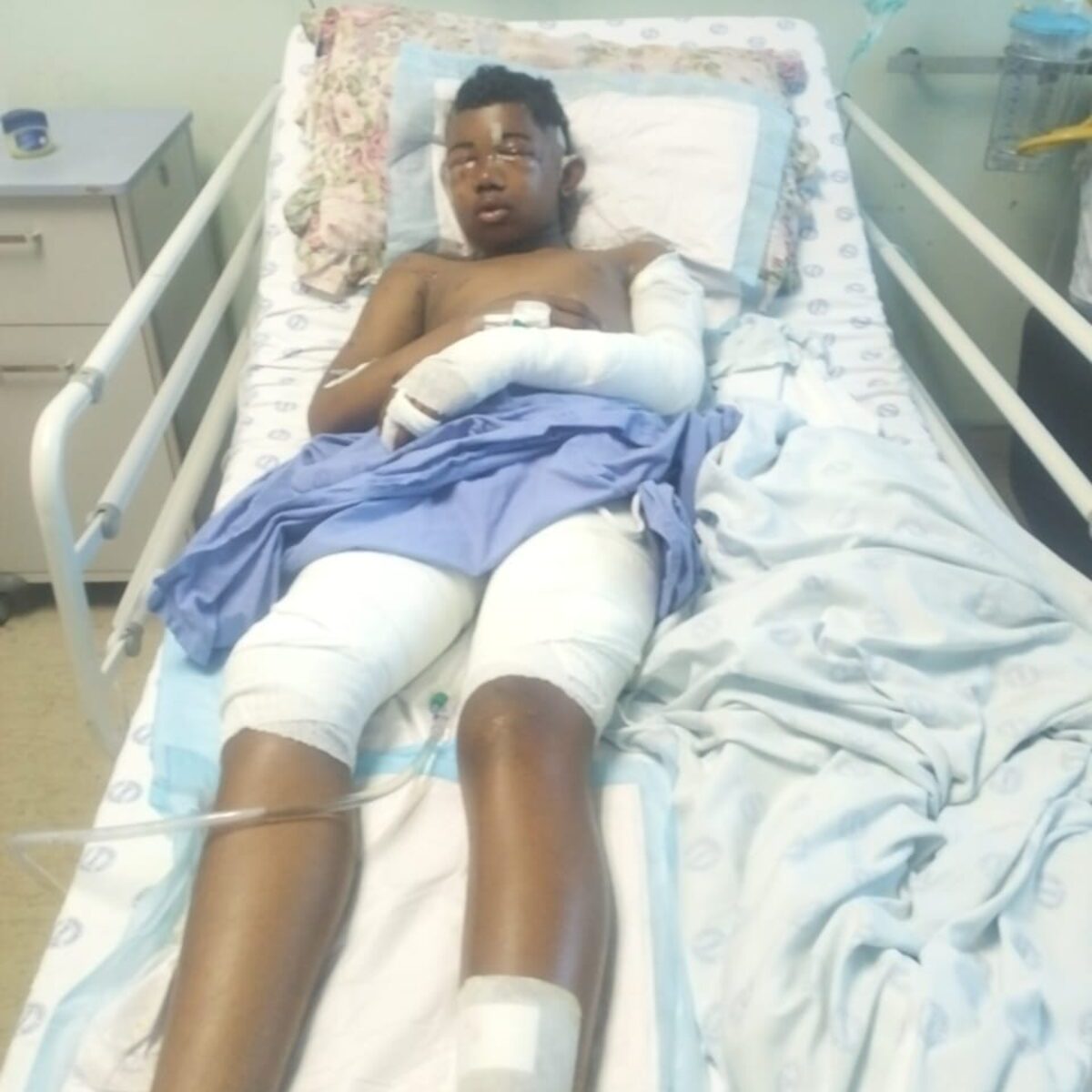dog attack on Sir Lowry's Pass farm