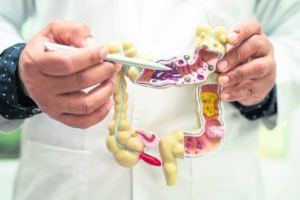 Cansa focuses on colon cancer