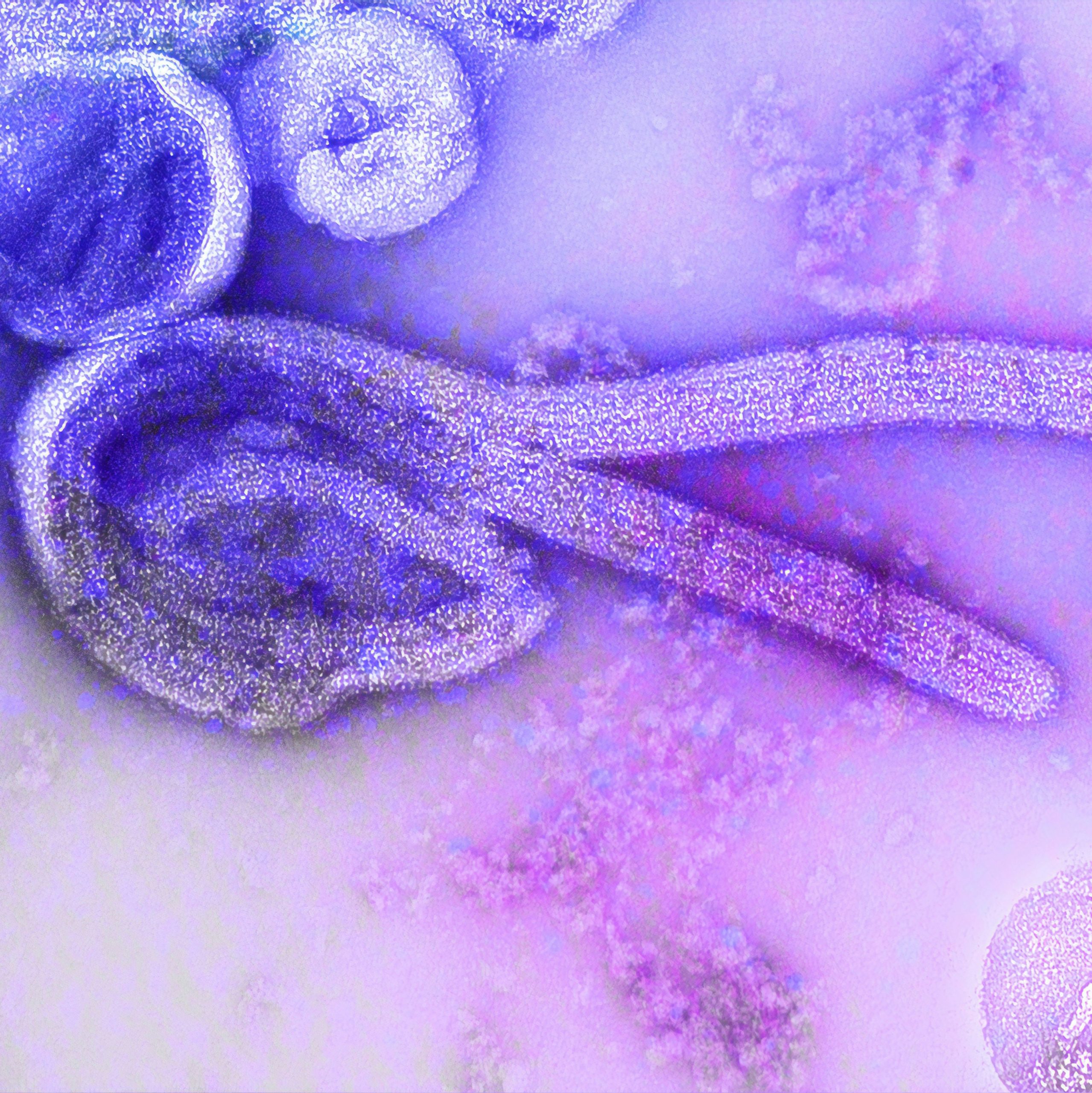 Nigeria has confirmed its first Ebola case as Kenya records ninth