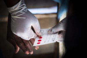 Major HIV study shows 2 decades of progress – and a troubling stall since 2019