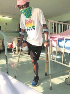 Avid athletic coach loses leg