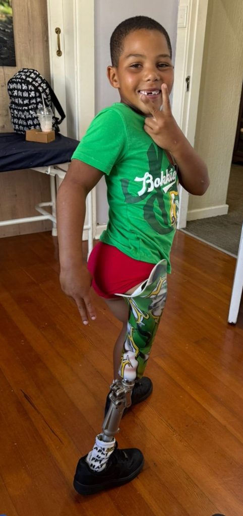 Oluthando "Olu" Nkosinkulu (7), a learner at Hankey Primary School, is embracing new opportunities after receiving a prosthetic leg thanks to the generosity of a doctor and a Good Samaritan.