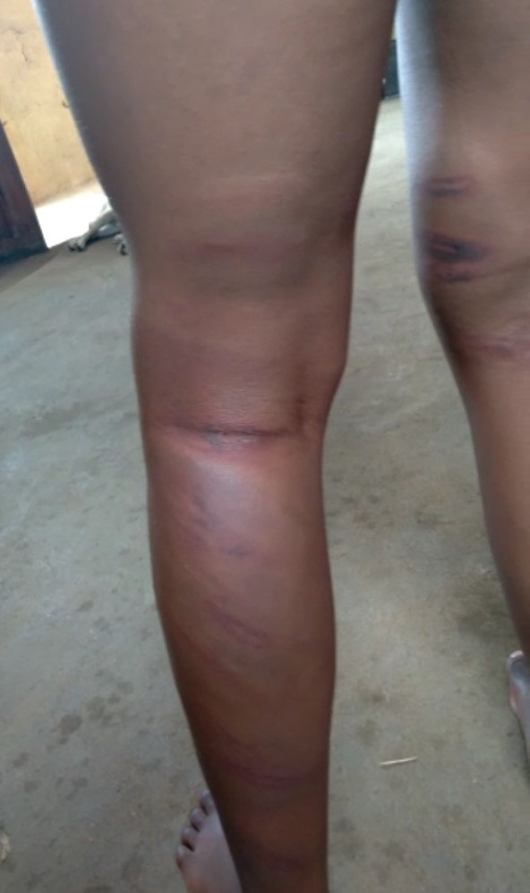 A 9-year-old learner was allegedly assaulted by he