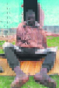 Man seeks help due to his skin condition