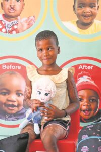 Power of smile is possible