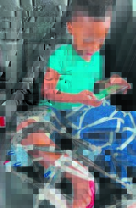 Surgery happening after 3 yrs of fundraising