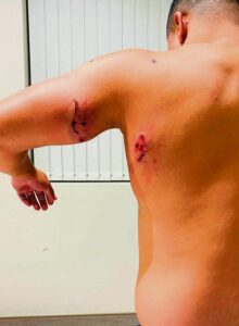 Chester soek geregtigheid ná erge pitboel-aanval