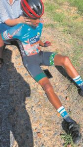 Cyclist is recovering well