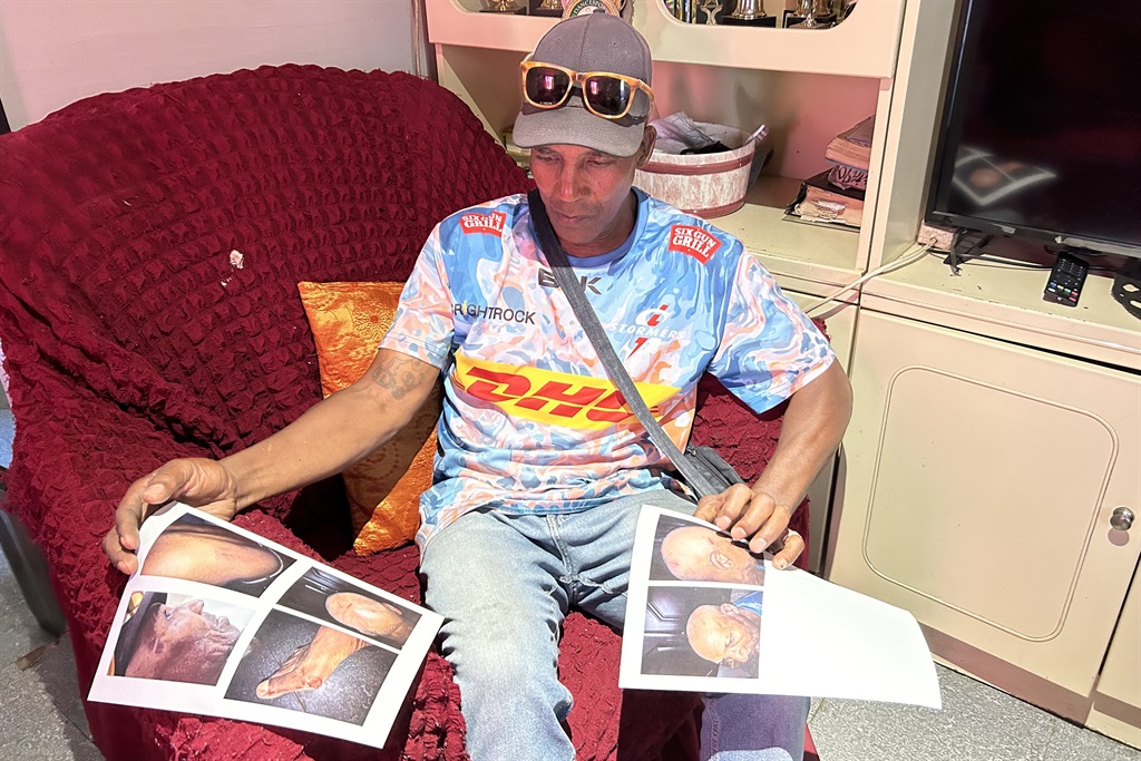 Geduld wys waar hy oral beseer is toe die groep po