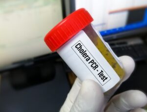 Interventions launched after cholera case confirmed in Nelson Mandela Bay