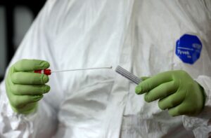 First case of monkeypox identified in SA