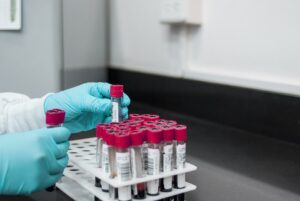Jury still out on new highly transmissible COVID-19 variant as Health Department embarks on fact-finding mission