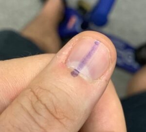 #IVoted: What can (and can’t) you post on election day?