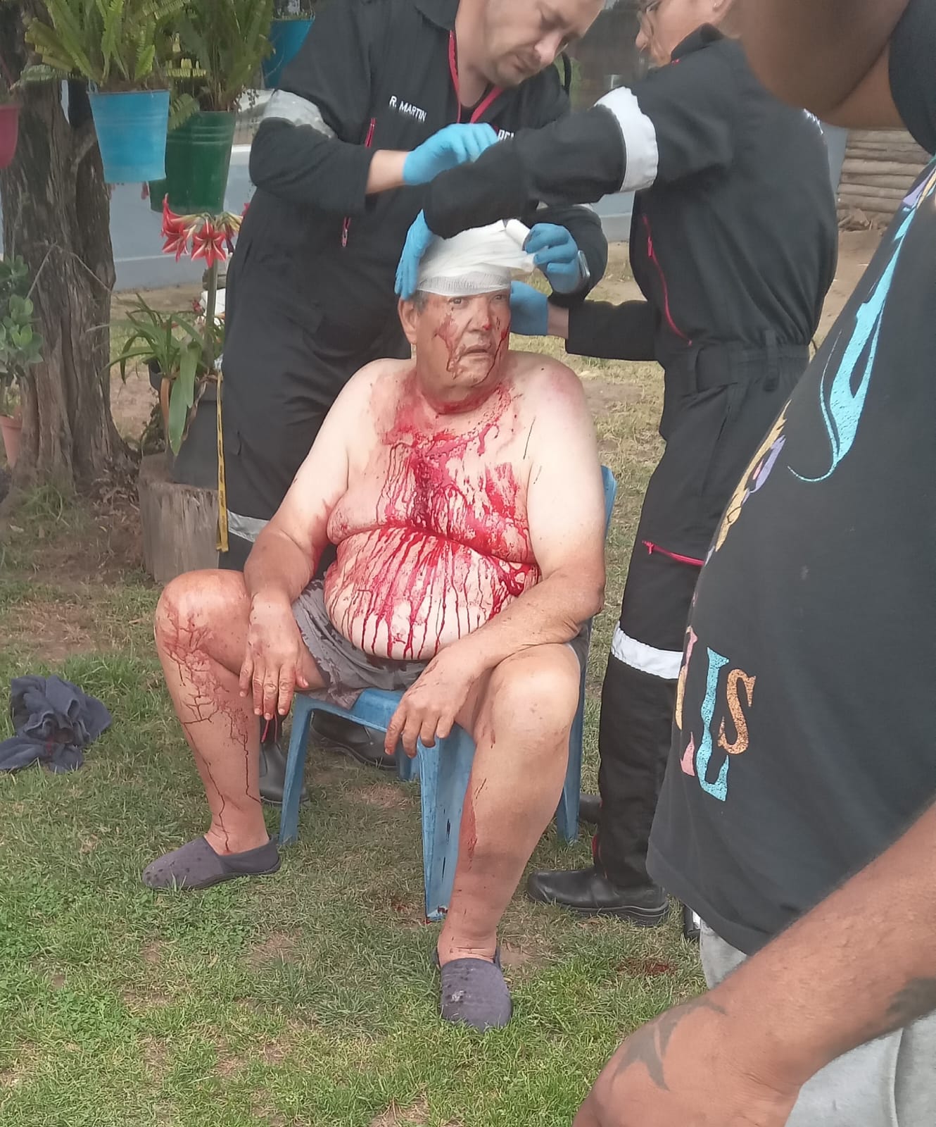 Hennie Smit sit met 'n verband op sy kop terwyl bloed af sy bors drup.