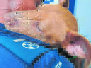 Locals stop dog fight, suspect not yet arrested