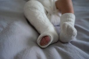 World Clubfoot day: celebrating 20 years of STEPS smpact