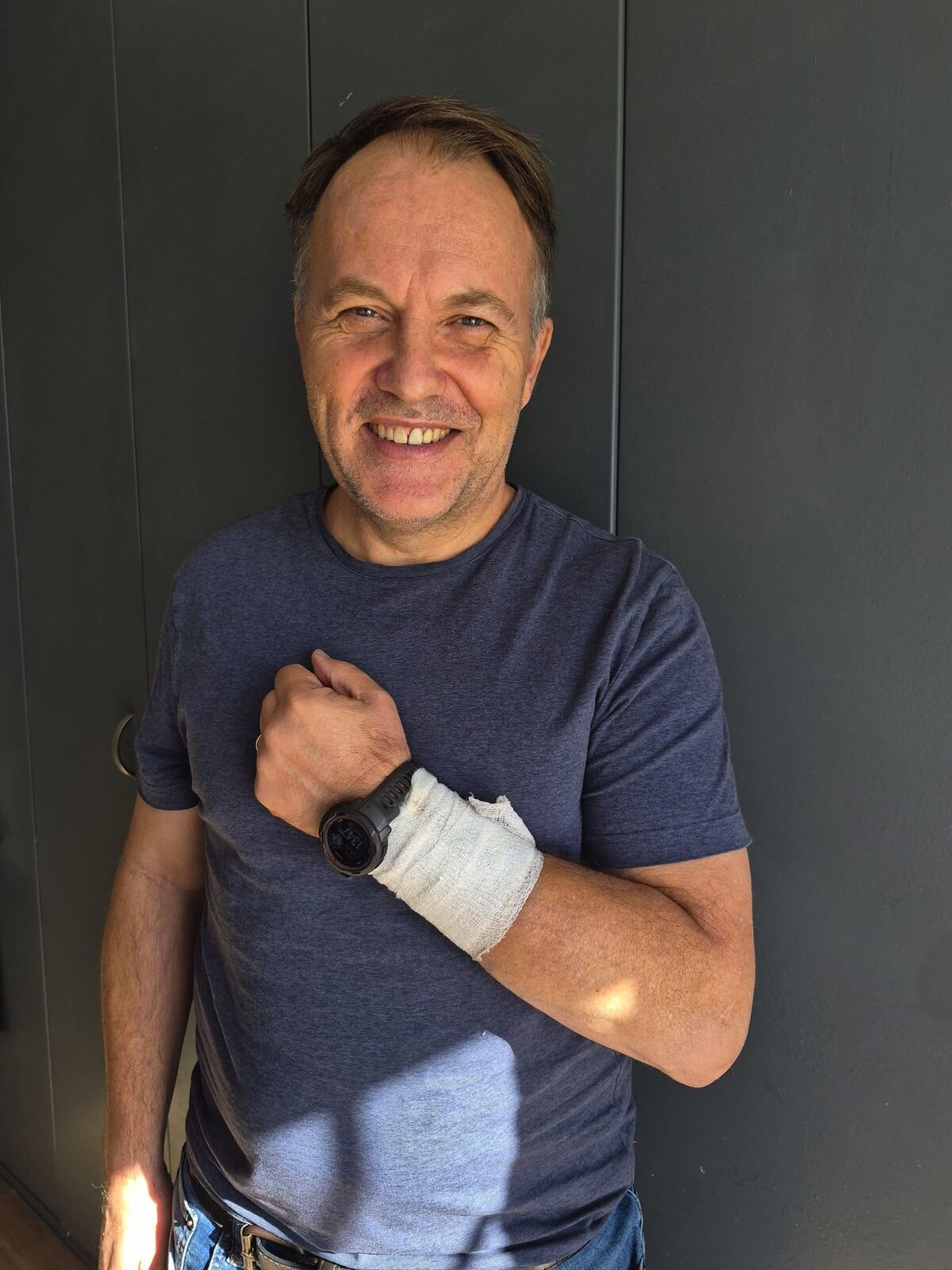 Runner Roger Pearce after surviving an attempted robbery and stabbing on Table Mountain near Deadman's Tree in Cape Town.