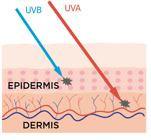 UVB+UFB