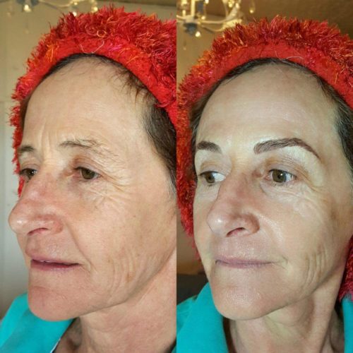 1. Microblading