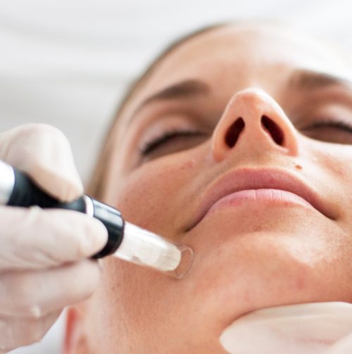 WEN: Laser beautique