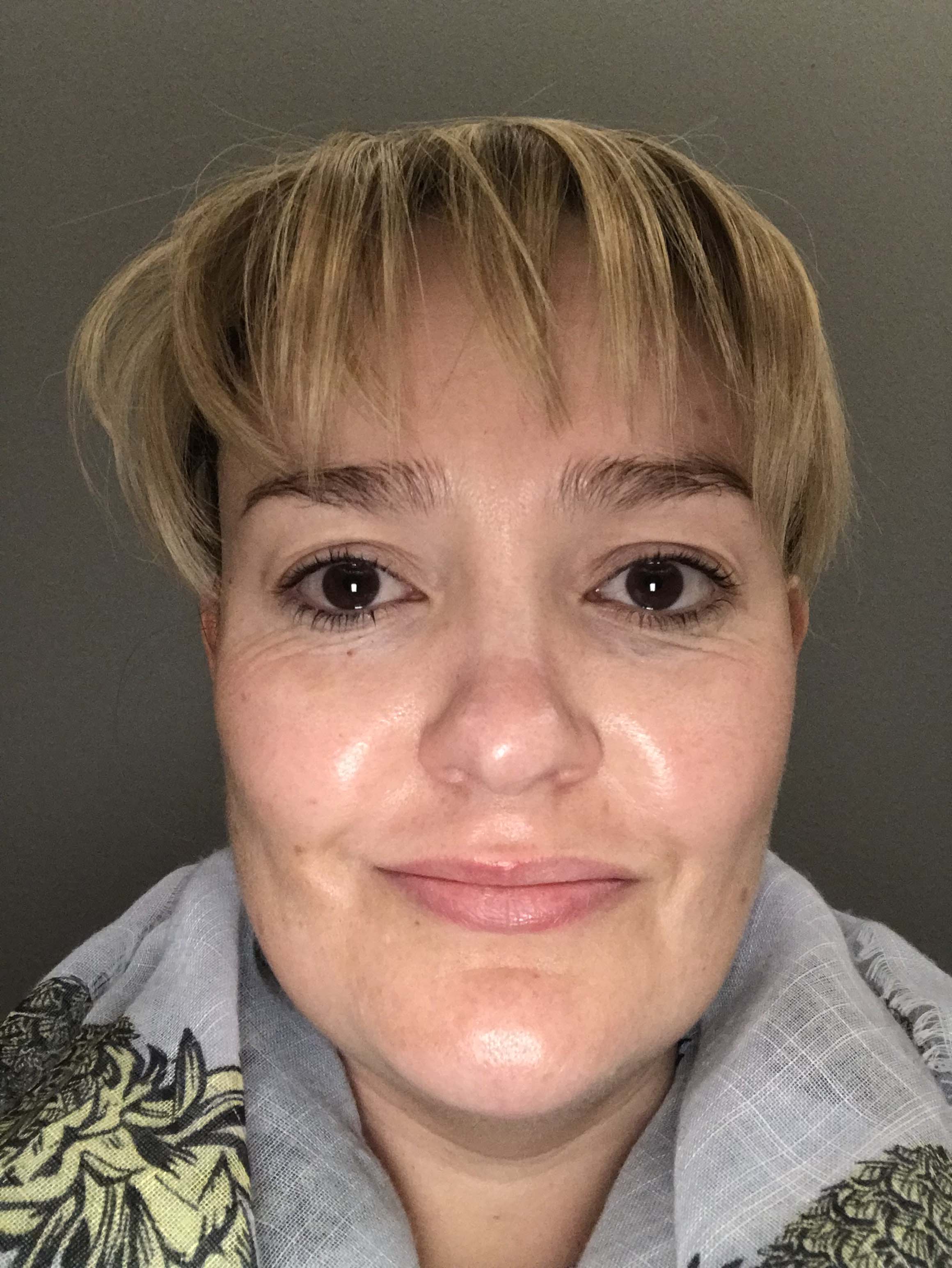 Ons toets Sorbet SK-N Microdermabrasion Silk Peel