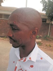 Robertson man claims assault