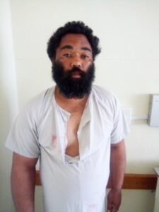 Unknown male patient at hospital