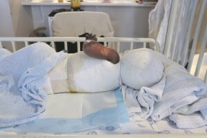 Western Cape child hospital raises awareness amid hundreds of annual cases of burns