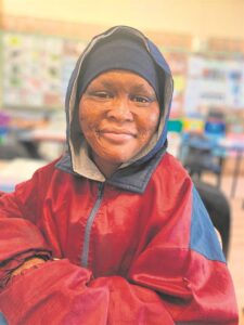 10 jaar ná 86% brandwonde aan lyf bly tiener (15) moedig