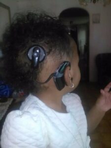 Toddler loses hearing after implant is stolen