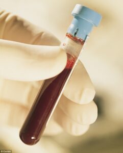 Give the hope of life and become stem cell donor