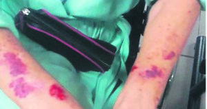 74-jarige vrou aangerand in Ruyterwacht