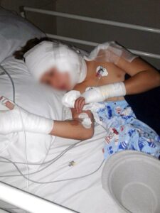 12-jarige seun 33 keer gesteek