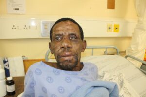 Unknown patient at Tygerberg Hospital