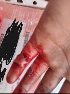 Patients ‘in danger’ after alleged gangster was shot