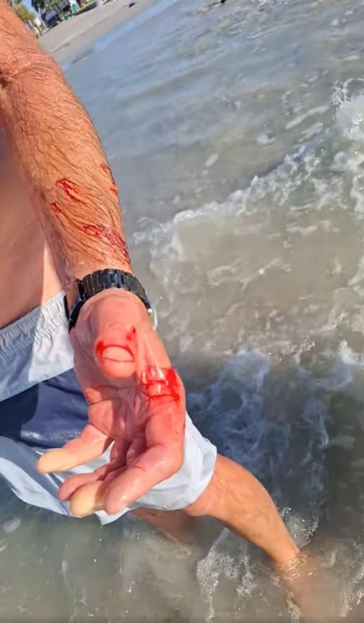 A man was attacked by a seal at Melkbosstrand Beach on Friday.