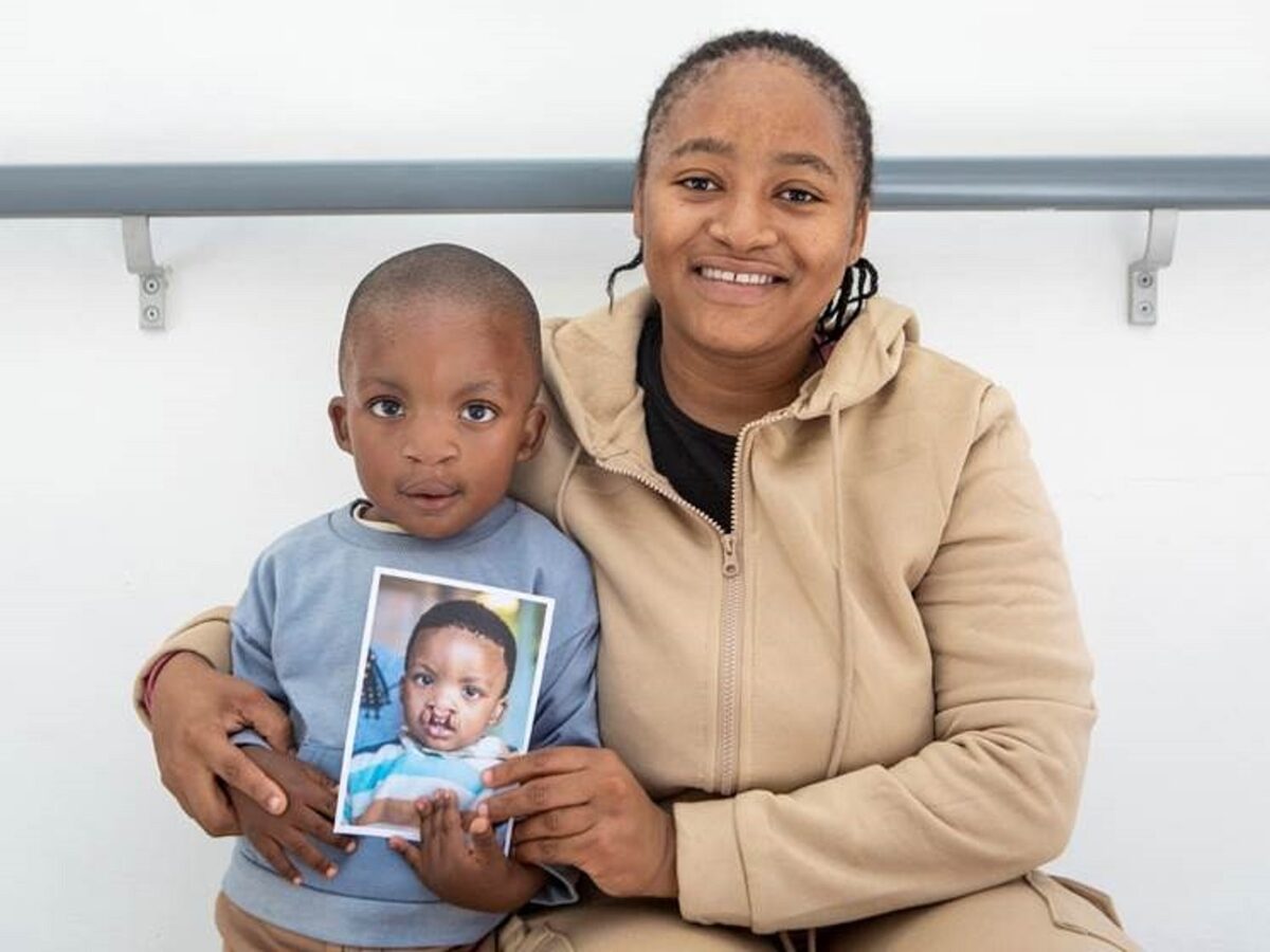 Lebone and Rorisang Tolomane after his cleft lip surgery