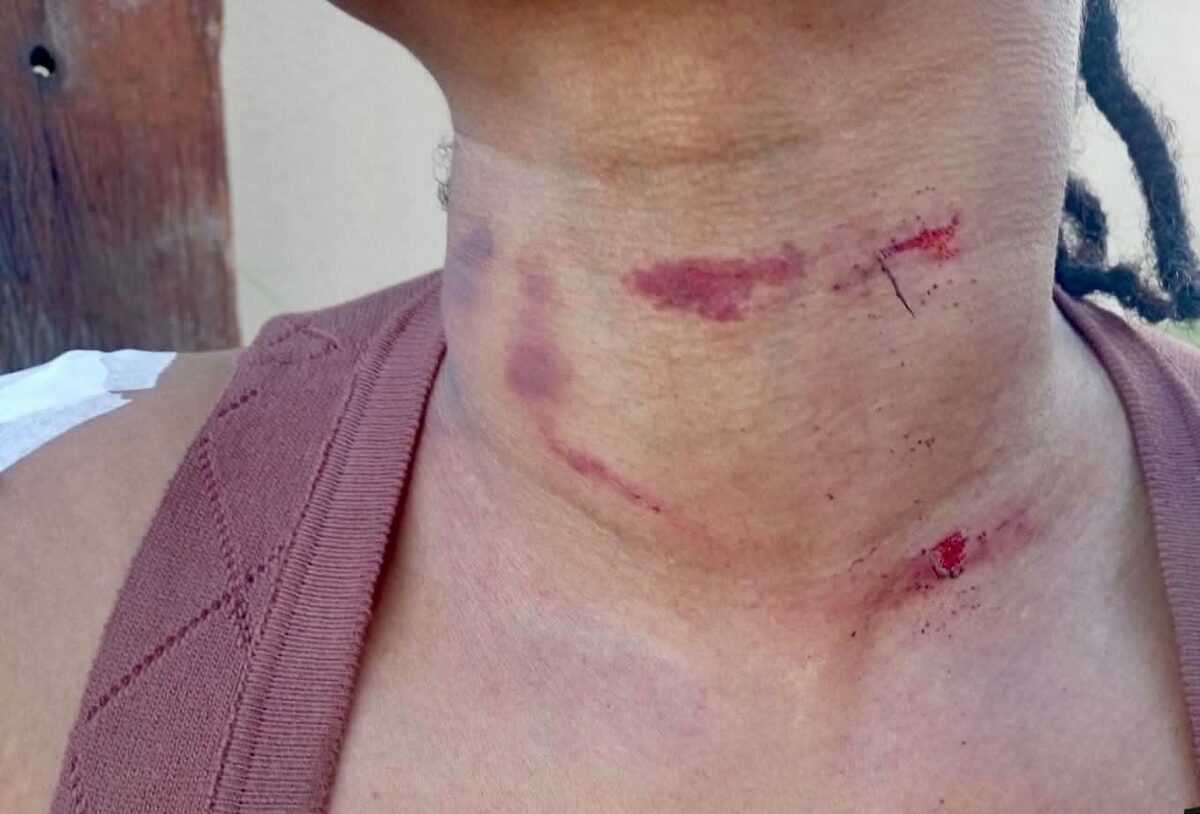 'n Kraaifontein vrou is na bewering deur 'n Uber-bestuurder aangerand.