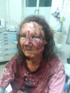 Vrou in boeie ná wrede aanval